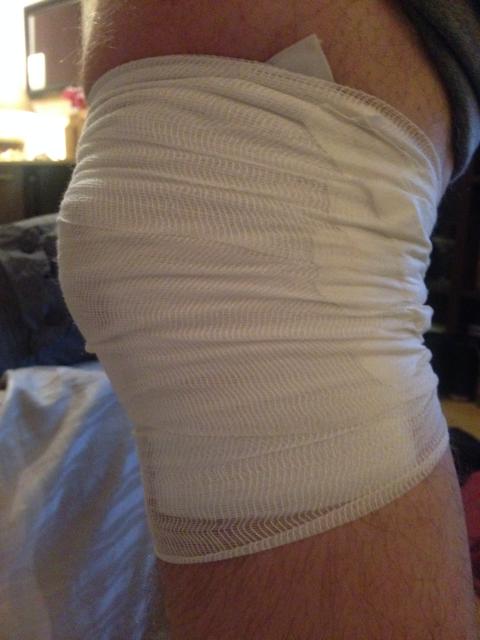 Officiellement blessé :-( J'ai le syndrome de l'essuie glace, Dunkerque - France — photo 3